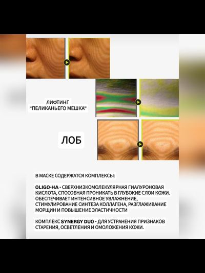RE-MERGE Эксклюзивная маска - корсет от птоза, брылей, второго подбородка 4шт.
