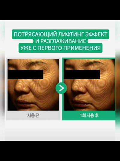 TERAPIC Система ухода с PDRN для омоложения и усиленной регенерации кожи (3 средства)