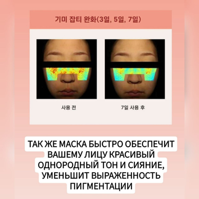REVCELL Маска - коллагеновый бандаж для интенсивного лифтинга 5шт.