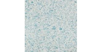 Жидкие обои Silk Plaster Рельеф (Relief) 329