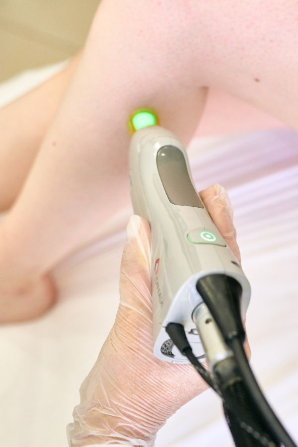 Как работает лазерная эпиляция - Cicada Clinic