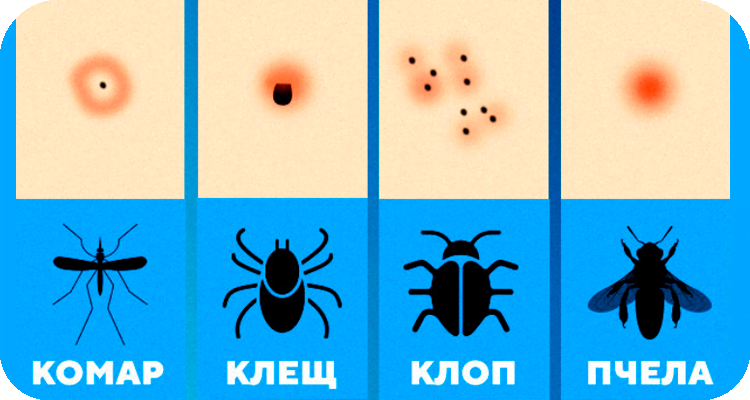 Виды укусов насекомых