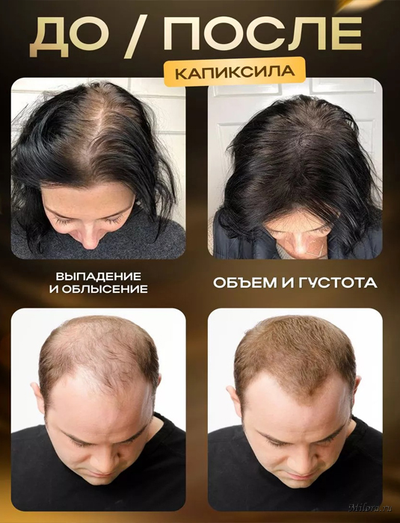 Капиксил на Milora.ru