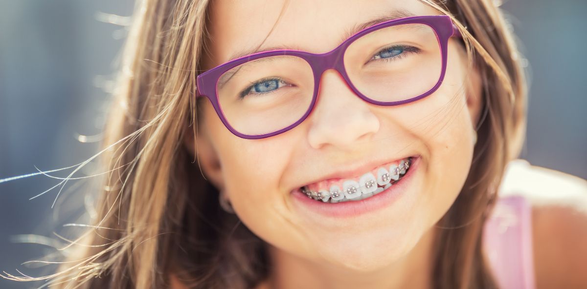 Брекеты - виды, цена, сколько стоит установка брекетов.