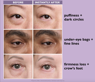 Peter Thomas Roth Instant Temporary Eye Tightener Easy-Wear Formula - Средство для временной подтяжки век