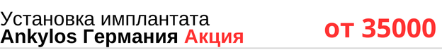 Установка имплантата Ankylos Германия по акции, цена