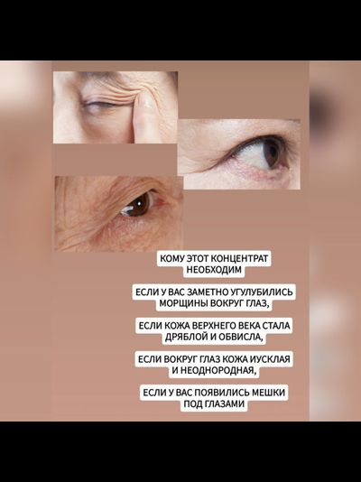 KREAM MILK Концентрат от мешков под глазами, для лифтинга и подтяжки нависшего века, разглаживания морщин 10гр.