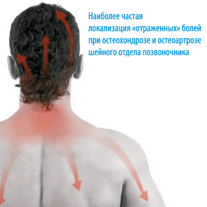 &laquo;ОТРАЖЕННЫЕ&raquo; БОЛИ. Дэнас ПКМ | Нейродэнс. 