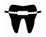 Ортодонтия (исправление прикуса)