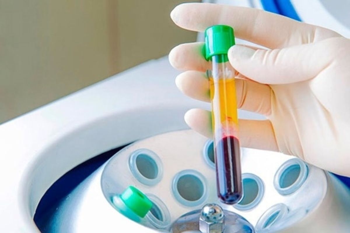 плазмолифтинг в Cicada Clinic