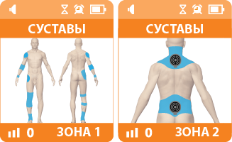 ДЭНАС при ишиасе. Программа "Суставы"