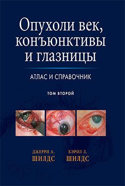 Опухоли век, конъюнктивы и глазницы. Атлас и справочник: в двух томах. Том 2. Джерри А. Шилдс, Кэрол Л. Шилдс. &quot;Издательство Панфилова&quot;. 2017