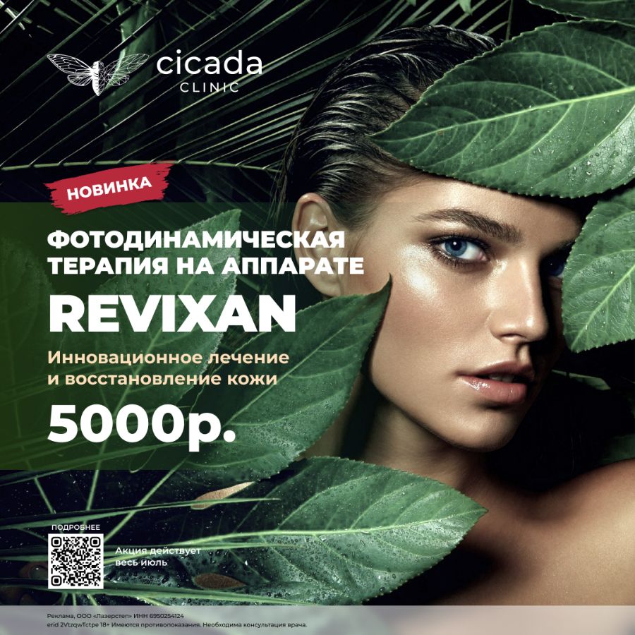 Фотодинамичская терапия в Cicada Clinic 
