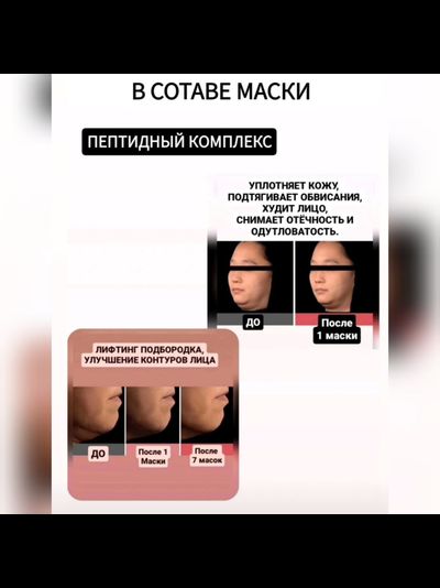 RE-MERGE Эксклюзивная маска - корсет от птоза, брылей, второго подбородка 4шт.