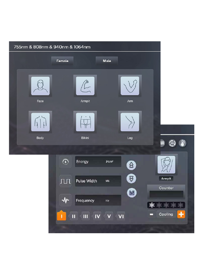 Диодный лазер FG2000D+ 1600Вт 808 нм