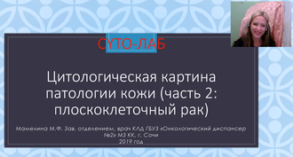 ЦИТОЛОГИЧЕСКАЯ КАРТИНА ПАТОЛОГИИ КОЖИ (Ч.2): всё о плоскоклеточном раке