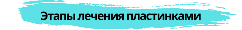 Надпись: этапы лечения зубными пластинками, АДентал