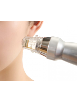 Фракционная мезотерапия