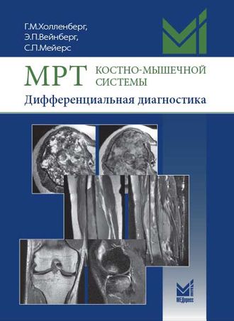 МРТ костно-мышечной системы. Дифференциальная диагностика. Холленберг Г.М., Вейнберг Э.П., Мейерс С.П. &quot;МЕДпресс-информ&quot;. 2018