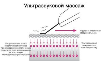 Ультразвуковой Скрабер KD-8020 (любимый инструмент косметологов)