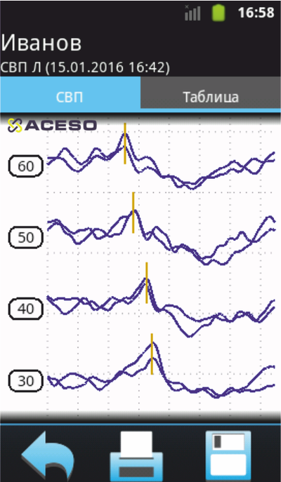 Аудио-СМАРТ cистема для ОАЭ, КСВП, импедансометрии и аудиологического скрининга