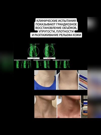 Dr.Melaxin Лифтинг уход для шеи: концентрат 1,5мл*10шт. и крем 50мл