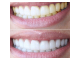 Отбеливающий карандаш для зубов Bright White оптом