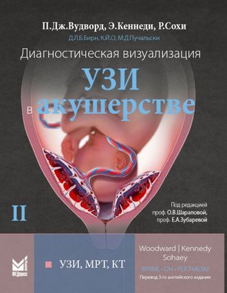 Диагностическая визуализация. УЗИ в акушерстве. Том.2. Пола Дж. Вудворд. &quot;МЕДпресс-информ&quot;. 2021