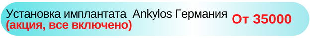 Установка импланта Ankylos