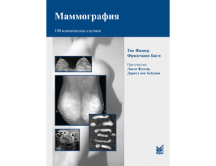 Маммография книга. Книги по маммографии. Атлас по маммологии. Маммография в двух проекциях. Маммография книга.
