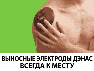 ВЫНОСНЫЕ ЭЛЕКТРОДЫ ДЭНАС ВСЕГДА К МЕСТУ