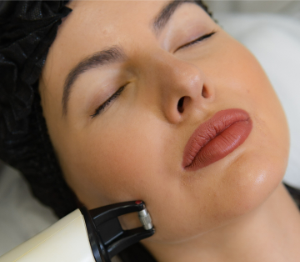 Фотоомоложение лица - Nordlys в Cicada Clinic