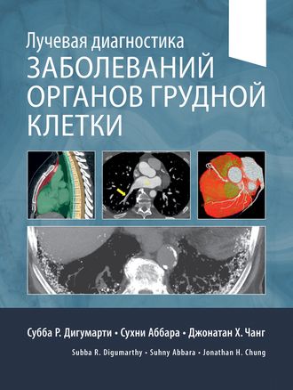 Лучевая диагностика заболеваний органов грудной клетки. Дигумарти С. Р. (комплект в 2-х книгах). &quot;Издательство Панфилова&quot;. 2023