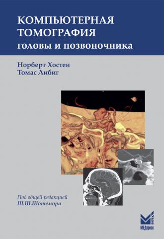 Компьютерная томография головы и позвоночника. Хостен Н., Либиг Т. 3-е издание. &quot;МЕДпресс-информ&quot;. 2017