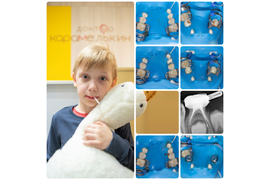 Лечение молочных зубов