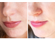 A313 чистый ретинол (50g) Vitamine A Pommade - Met Retinol. Крем против морщин, от прыщей и черных точек