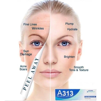 A313 Vitamine A Pommade (50g) - Met Retinol. Крем против морщин, от прыщей и черных точек