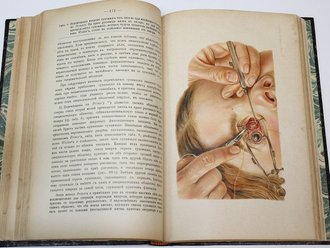 Хааб О. Атлас и очерк учения о глазных операциях. СПб.: `Практическая  медицина`, 1906.