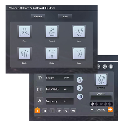 Диодный лазер FG2000D+ 1600Вт 808 нм