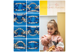 Лечение молочных зубов