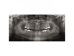 Gendex GXDP-300™ - Цифровая панорамная рентгенодиагностическая система | KAVO DENTAL (Германия)