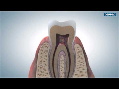 Зубная паста ортодонтическая c яблочно-мятным вкусом Vitis Orthodontic, Dentaid, 100 мл.