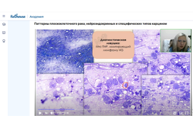Цитологическая диагностика метастазов (онлайн курс)