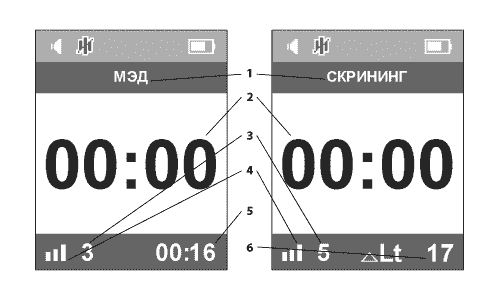 Окно в режимах МЭД и «Скрининг» аппарата ДЭНАС ПКМ