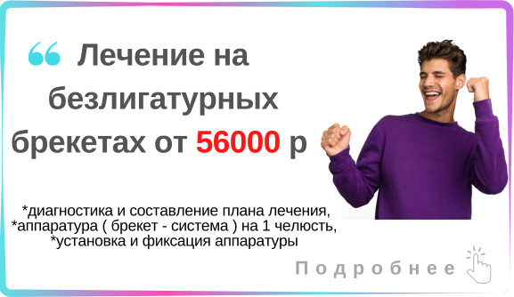 Исправление прикуса брекетами по акции в Новосибирске.