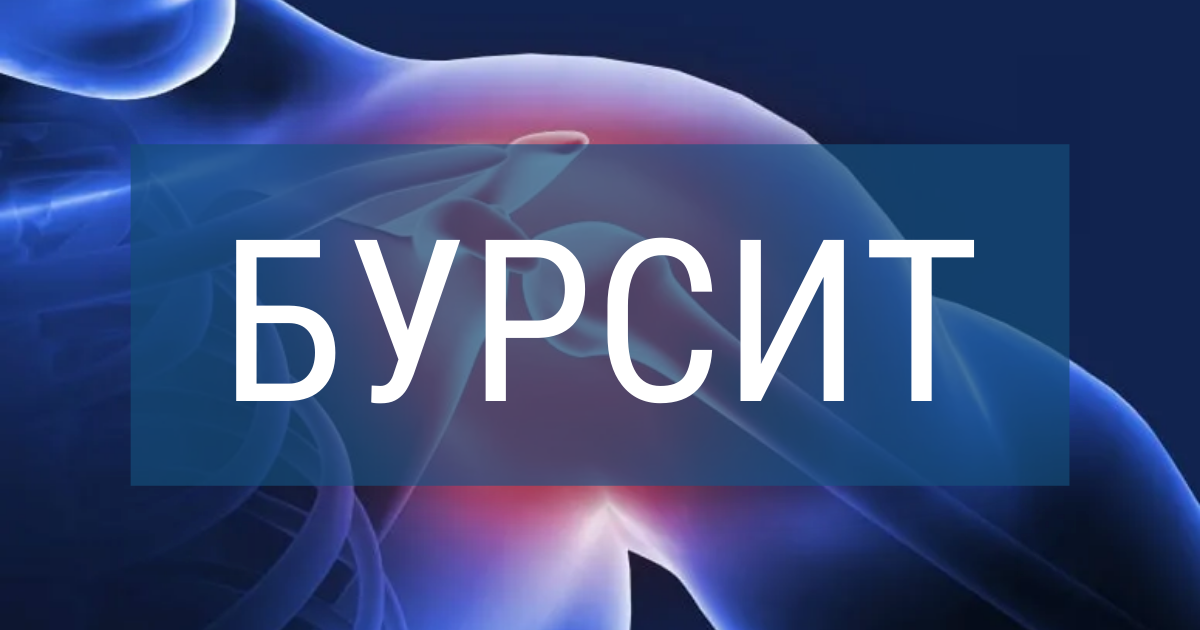 Хронический бурсит с отложение кальция. Хронический бурсит - причины, симптомы и лечение — Net-Bolezniam.Ru Хирургическая инфекция - презентация онлайн Лечение и диагностика бурсита. Как развивается бурсит