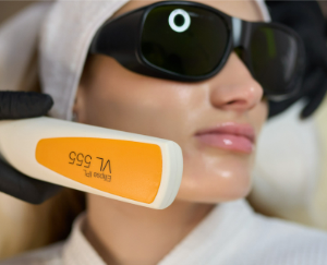 Фотоомоложение лица - Nordlys в Cicada Clinic