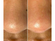 Dermaflash DERMAPORE+ Ultrasonic Pore Extractor - Ультразвуковое устройство для очищения кожи