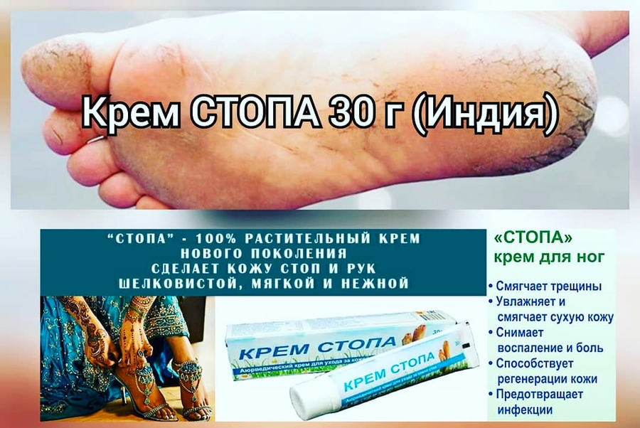 Крем для ног СТОПА (Индия) 30 г