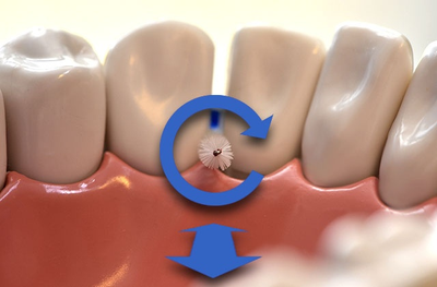 Ершики межзубные 0,9 мм, зеленые, Micro Interdental, Pierrot, 5 шт.